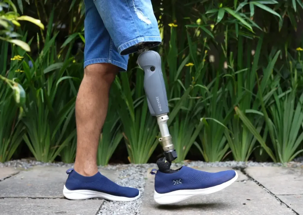 person with lower limp prosthesis walking image