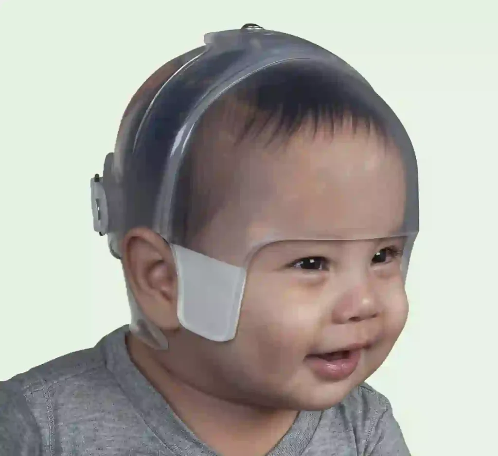 happy baby with transparent starlight bi valve infant head shaping helmet