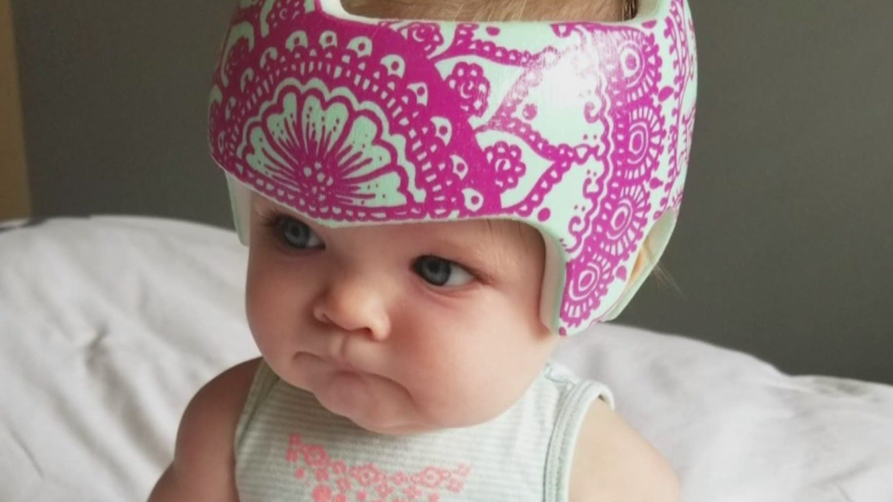 comfortable kid with head shaping helmet for flat head syndrome