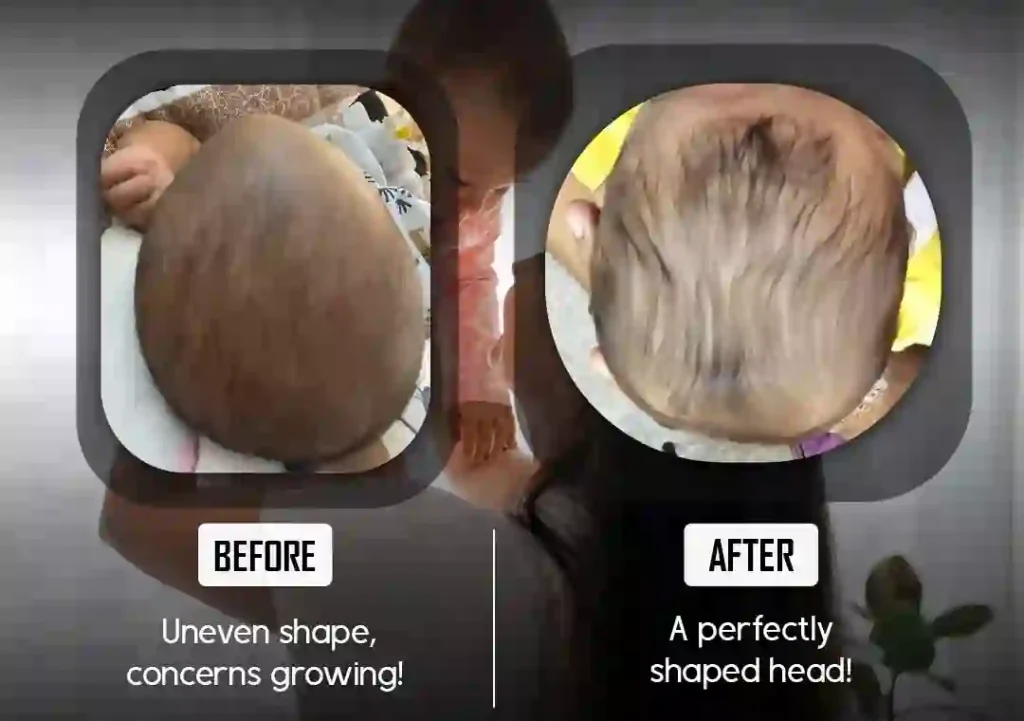 cranial helmet before and after image