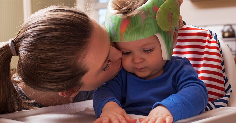 baby using a cranial helmet