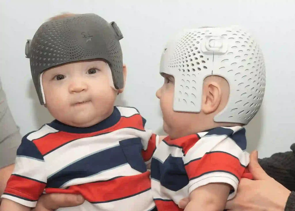 two babies wearing starband 3d cranial helmet