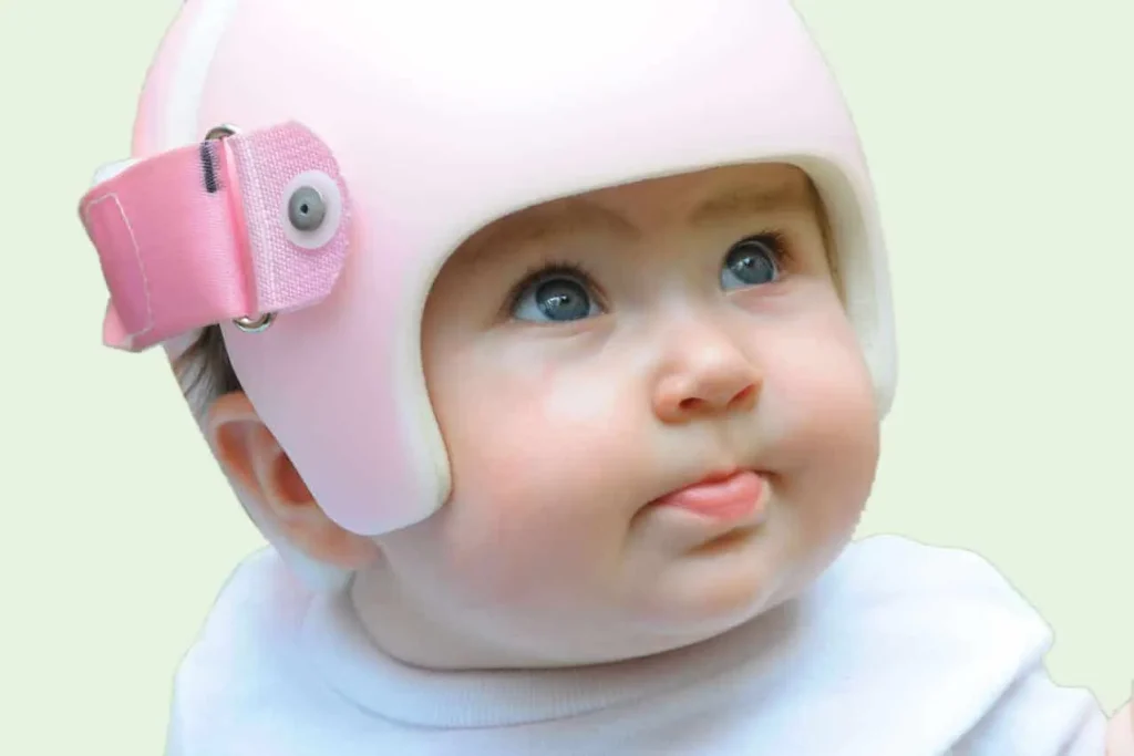 happy kid with starband side opening cranial orthosis