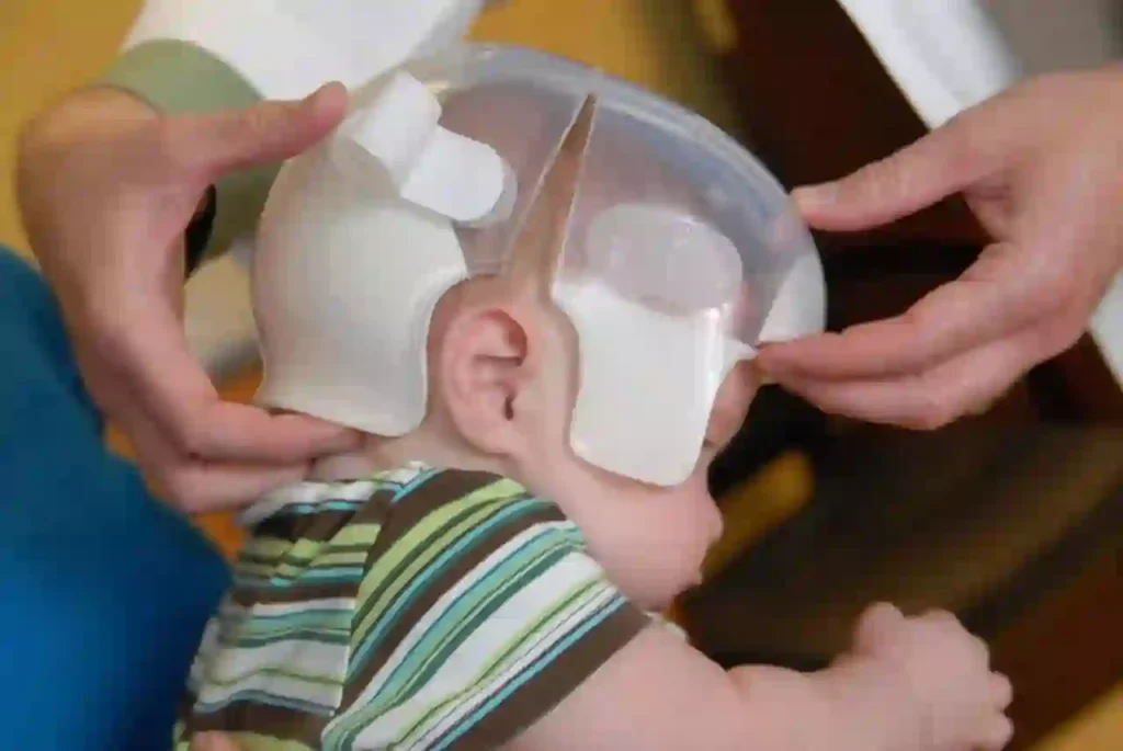 doctor consulting baby with a starlight pro baby head shaping helmet