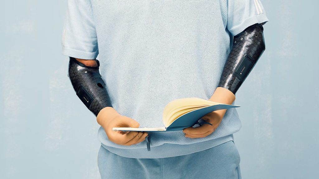 Advantages of artificial hand