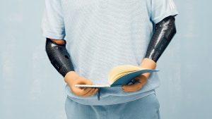 Advantages of artificial hand