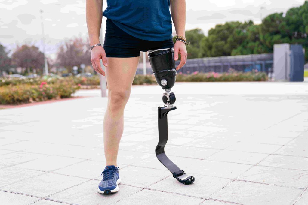 man with an above knee artificial leg doing daily activity