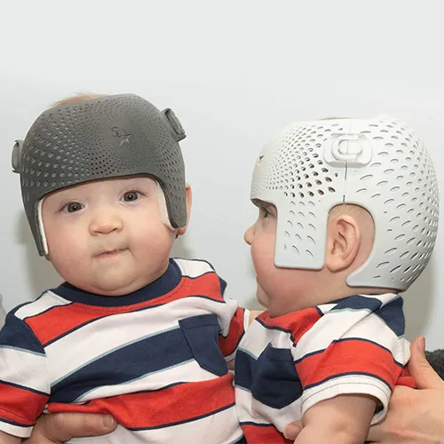 Flat spot on back of a baby's head due to baby flat head syndrome
