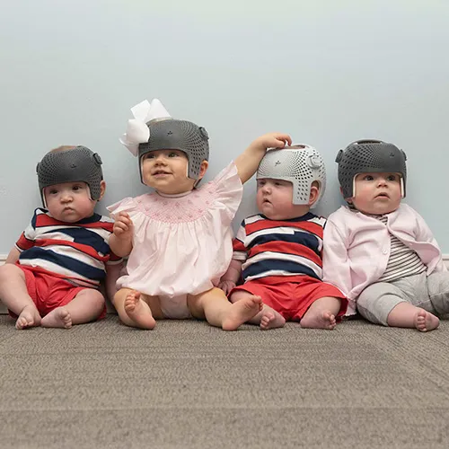 Flat spot on back of a baby's head due to baby flat head syndrome