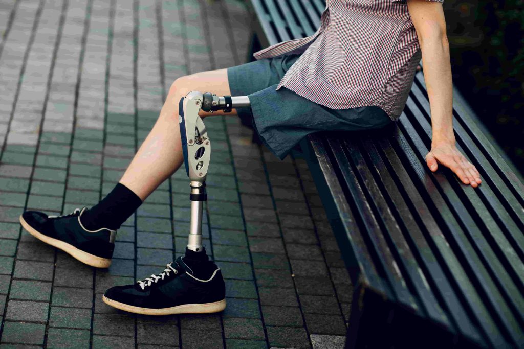 man with an artificial Leg above Knee