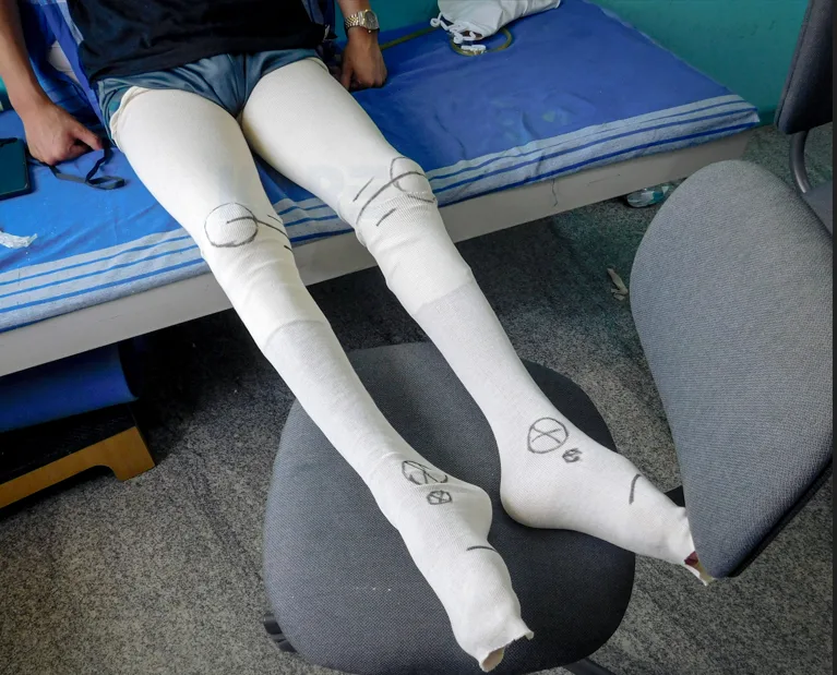 HKAFO orthosis supporting hip, knee, ankle, and foot for improved mobility