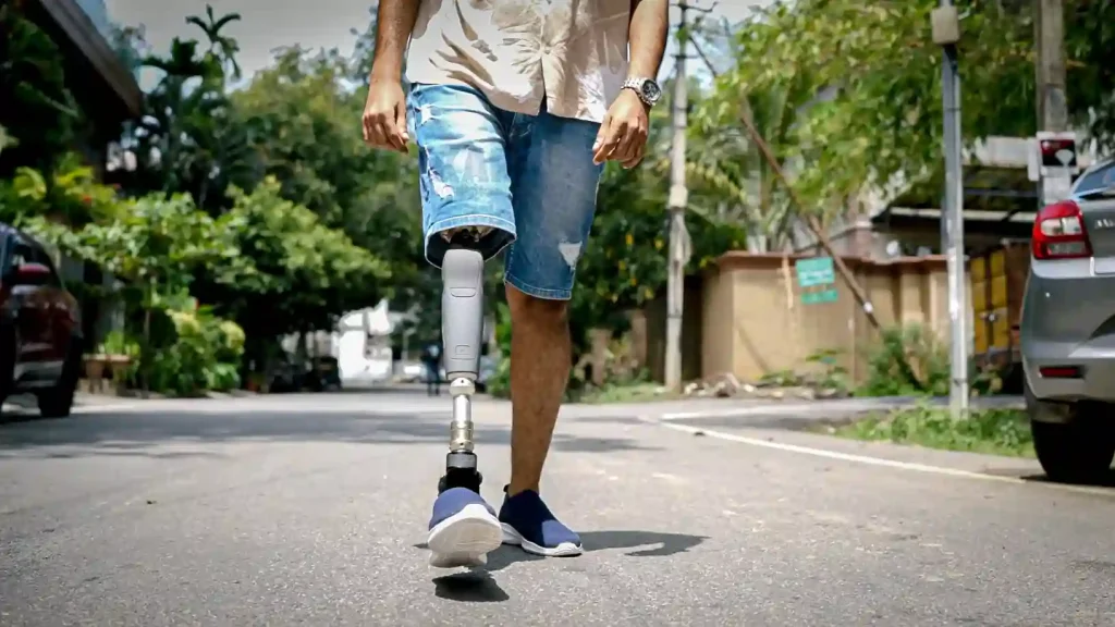 walking confidently with an ideal artificial limbs solution