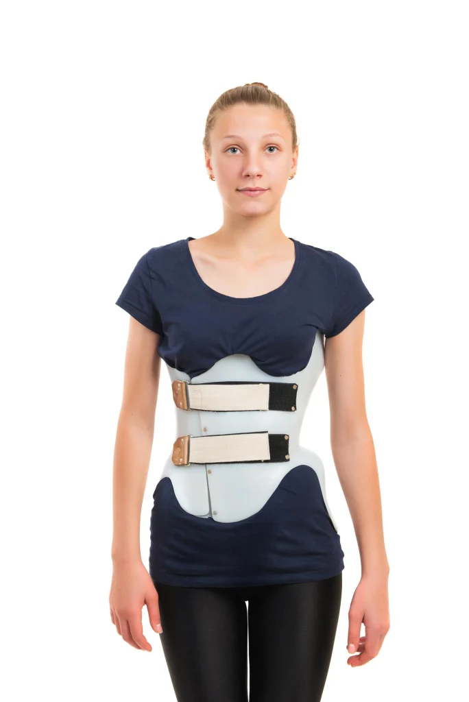 Patient with scoliosis wearing a TLSO brace for correction