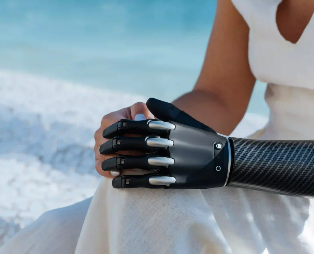 Bionic arm prosthetic in India designed for advanced mobility and daily use