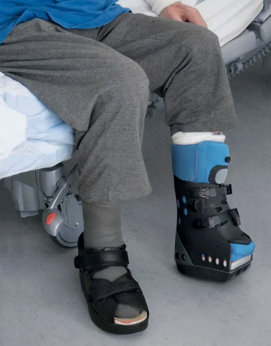 Orthotic device designed to support walking and balance after partial foot amputation