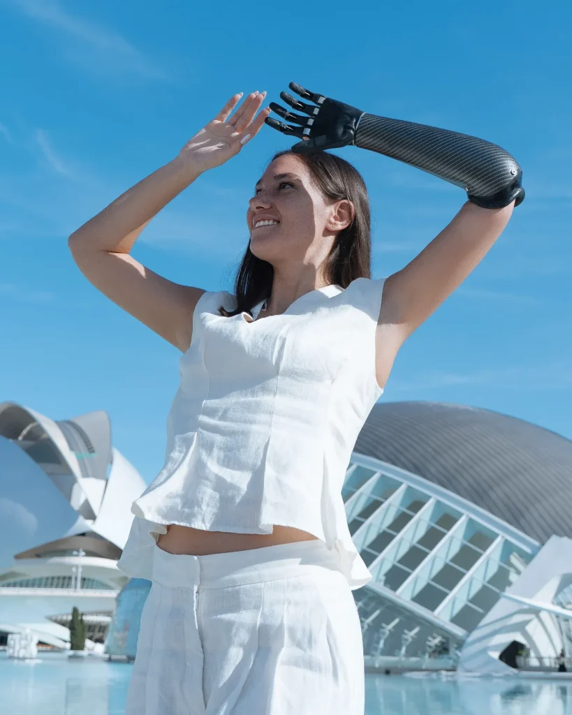 Prosthetic fingers with mechanical joints for improved grip and daily hand function