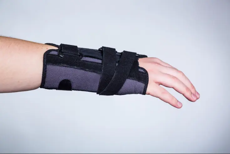 wrist drop splint supporting the hand in an extended position to treat radial nerve injury