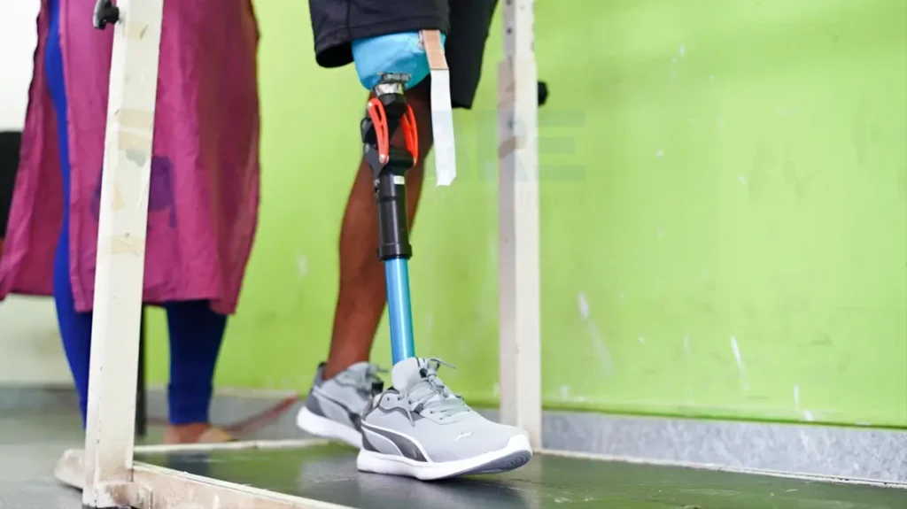amputee performing rehabilitation exercises after amputation to restore balance, mobility, and strength