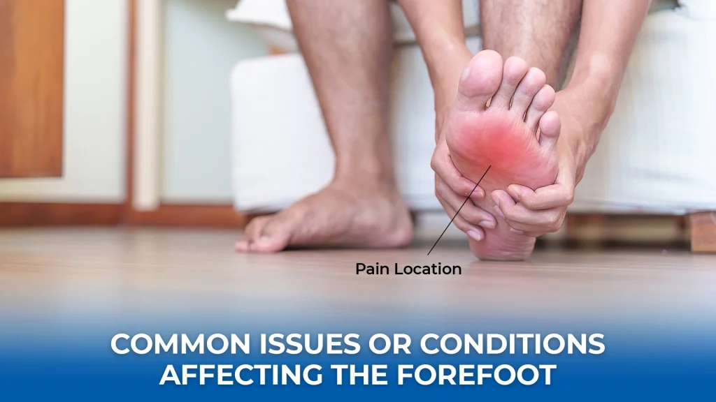 Common Issues or Conditions Affecting the Forefoot
