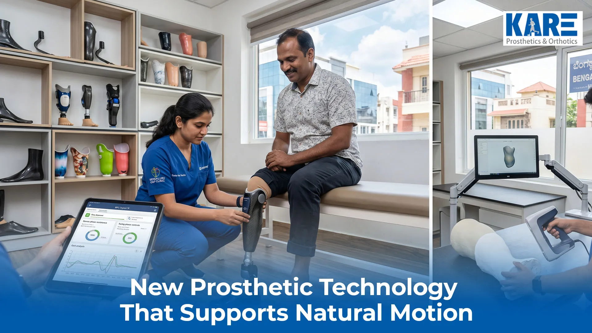 New Prosthetic Technology That Supports Natural Motion
